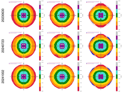 8EGN_plain_XDS_staraniso_xds_alldata.ismean-hkl.png