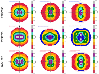 8UFN_plain_XDS_staraniso_xds_alldata.ismean-hkl.png