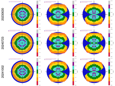 8WT3_autoPROC_staraniso_alldata.ismean-hkl.png